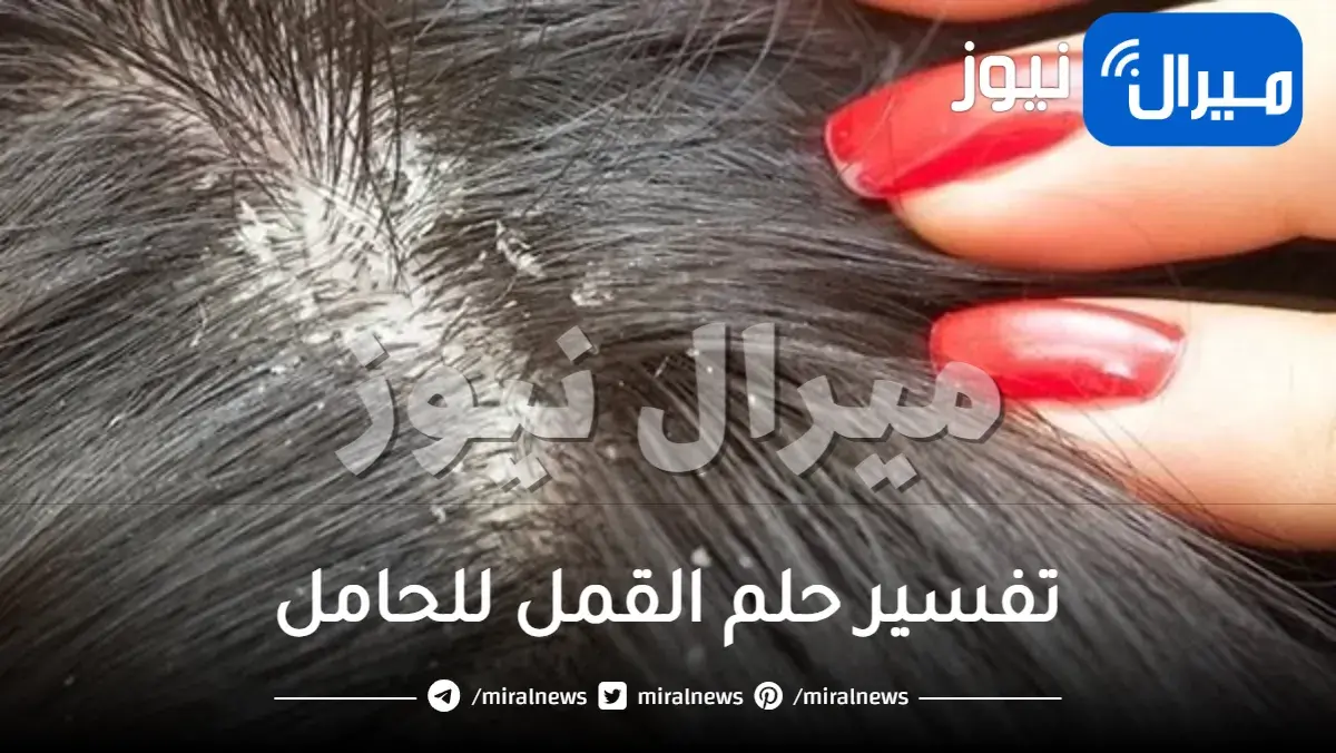 تفسير حلم القمل للحامل