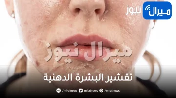 طريقة تقشير البشرة الدهنية .. 8 طرق