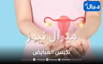 تكيس المبايض