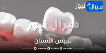 تلبيس الأسنان