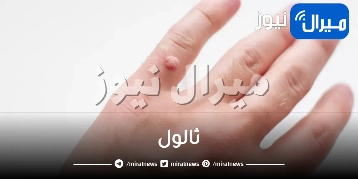 ثالول