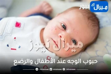أسباب ظهور حبوب الوجه عند الأطفال والرضع