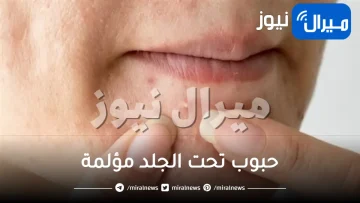 طرق علاج حبوب تحت الجلد مؤلمة