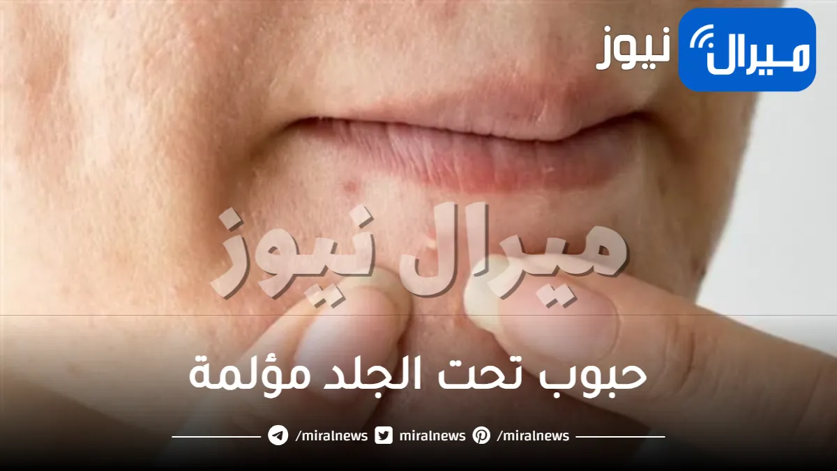 طرق علاج حبوب تحت الجلد مؤلمة