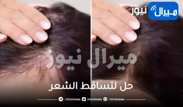 أفضل 7 حلول لتساقط الشعر