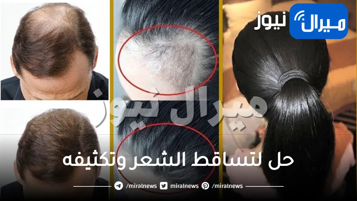 حل لتساقط الشعر وتكثيفه