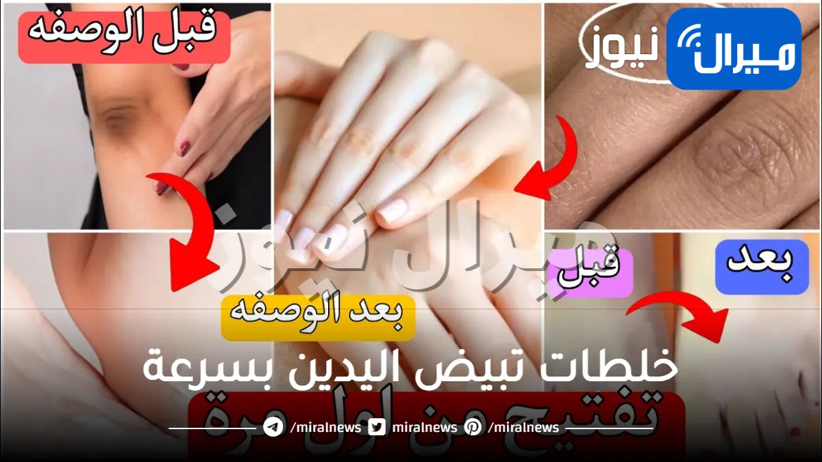 خلطات تبيض اليدين بسرعة مضمونه ومجربة ومن أول مرة