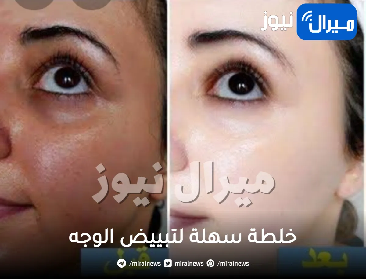 خلطة سهلة وسريعة لتبييض الوجه