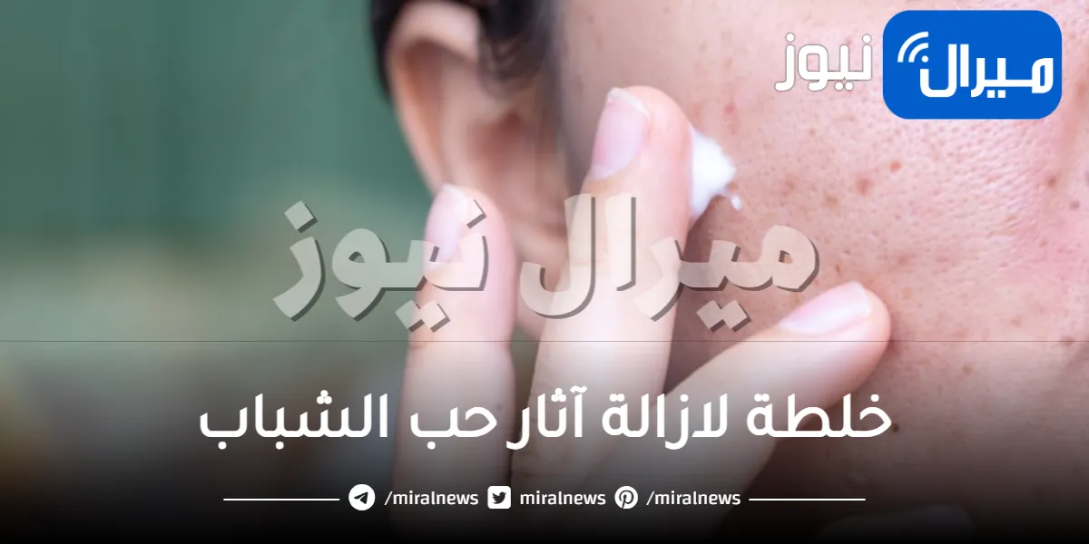 تجربتي مع اثار حب الشباب؛ 3 مكونات لتحضير خلطة لازالة آثار حب الشباب من أول استعمال