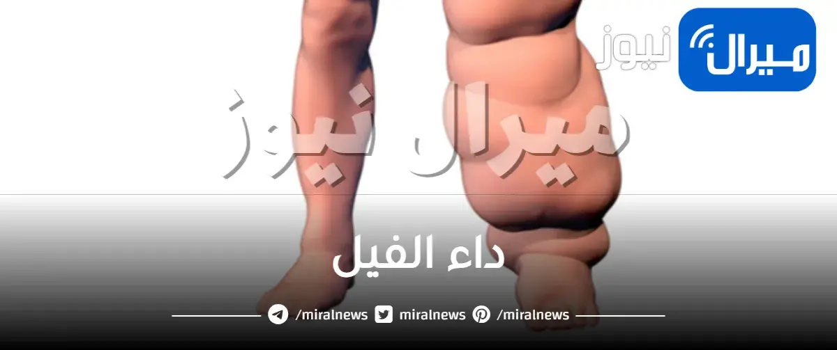 داء الفيل