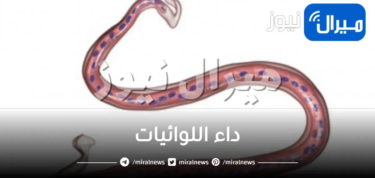 داء اللوائيات
