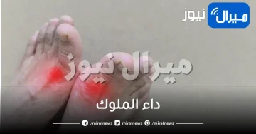 داء الملوك