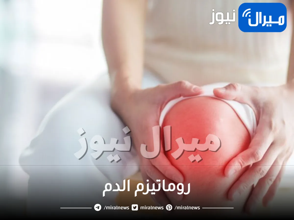 روماتيزم الدم