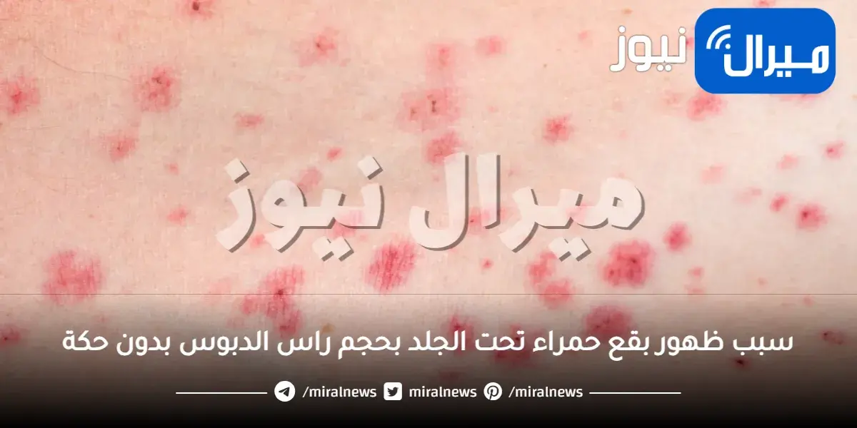 سبب ظهور بقع حمراء تحت الجلد بحجم راس الدبوس بدون حكة