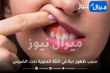 سبب ظهور حبة في اللثة العلوية تحت الضرس غير مؤلمة