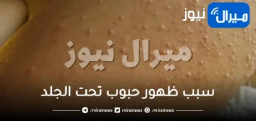 ما سبب هو ظهور حبوب تحت الجلد