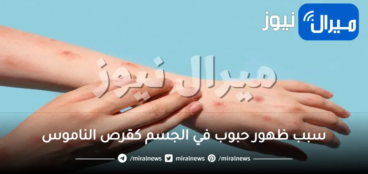 سبب ظهور حبوب في الجسم كقرص الناموس مع الحكة عالم حواء