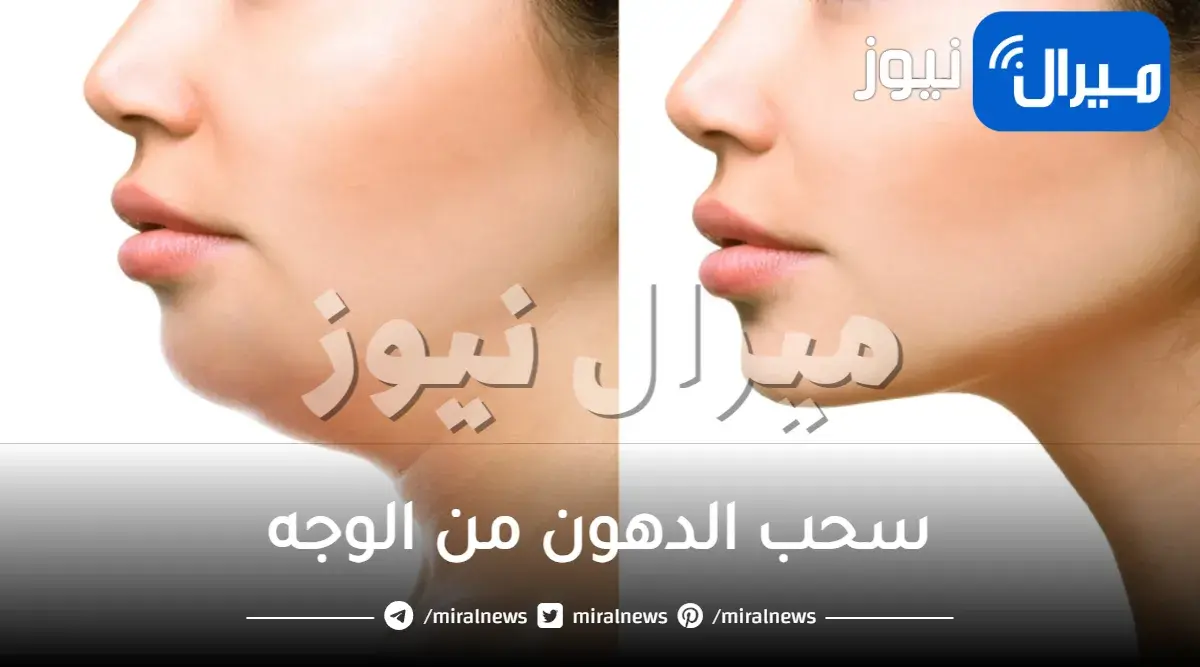 كيف تسحب الدهون من الوجه