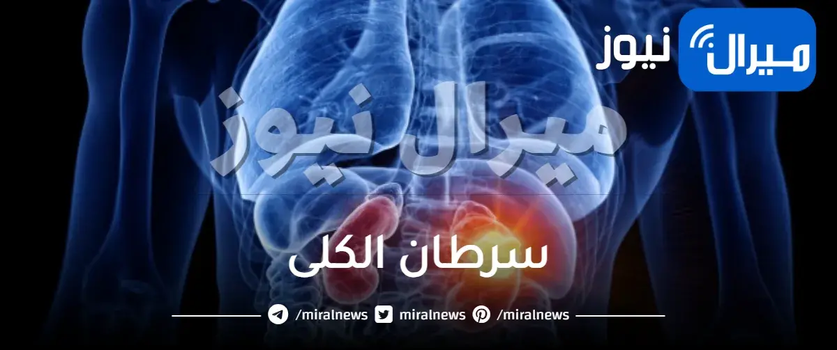 سرطان الكلى اعراضه واسبابه وكيفية علاجه
