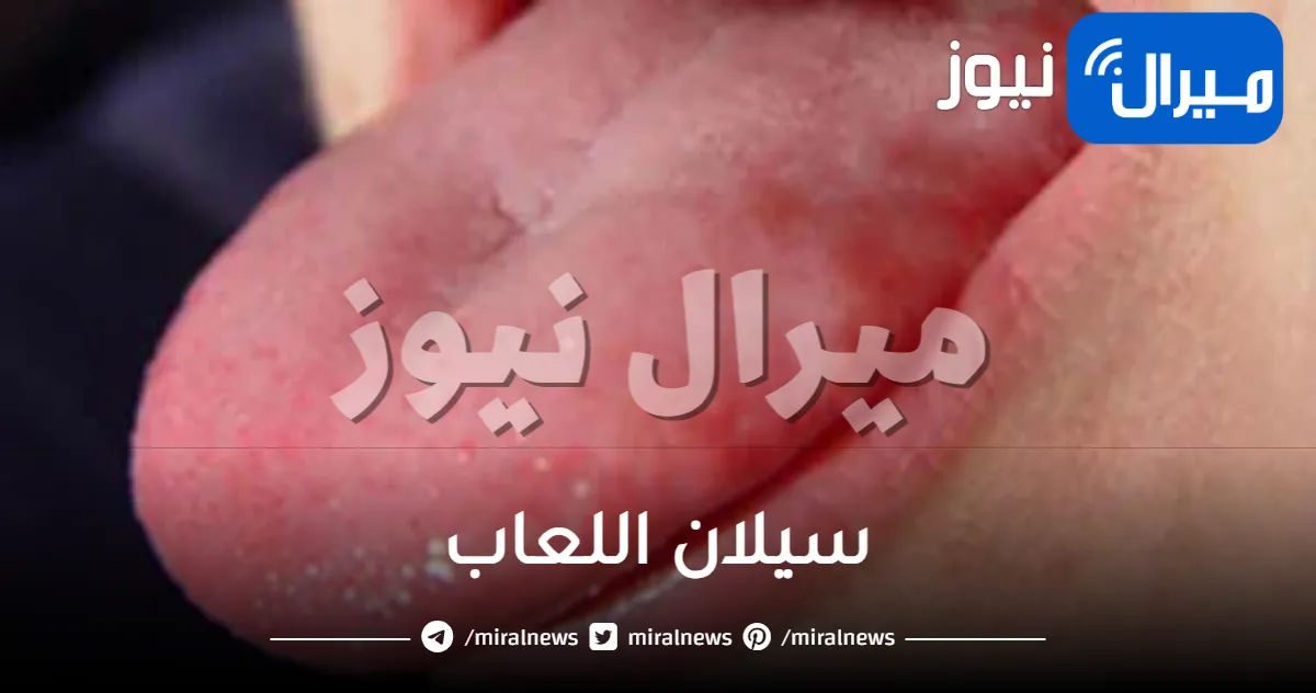 سيلان اللعاب