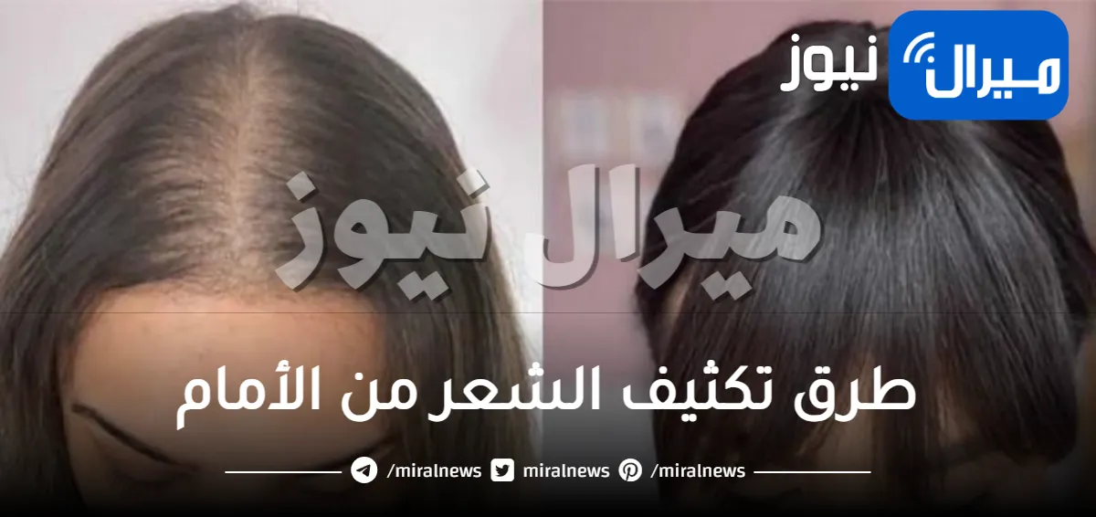 كيفية تكثيف الشعر من الأمام بسرعه