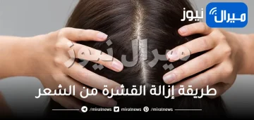 طريقة إزالة القشرة من الشعر وأفضل الوصفات الطبيعية