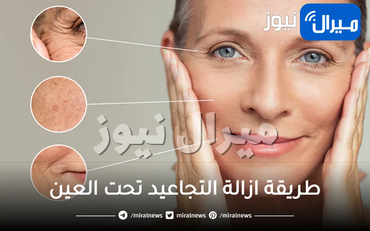 طريقة ازالة التجاعيد تحت العين