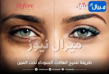 تفتيح الهالات السوداء تحت العين بسرعة