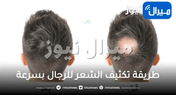 طريقة تكثيف الشعر للرجال بسرعة