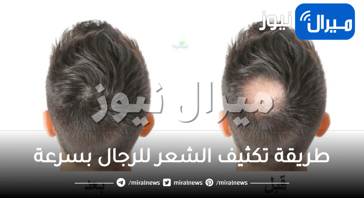 طريقة تكثيف الشعر للرجال بسرعة
