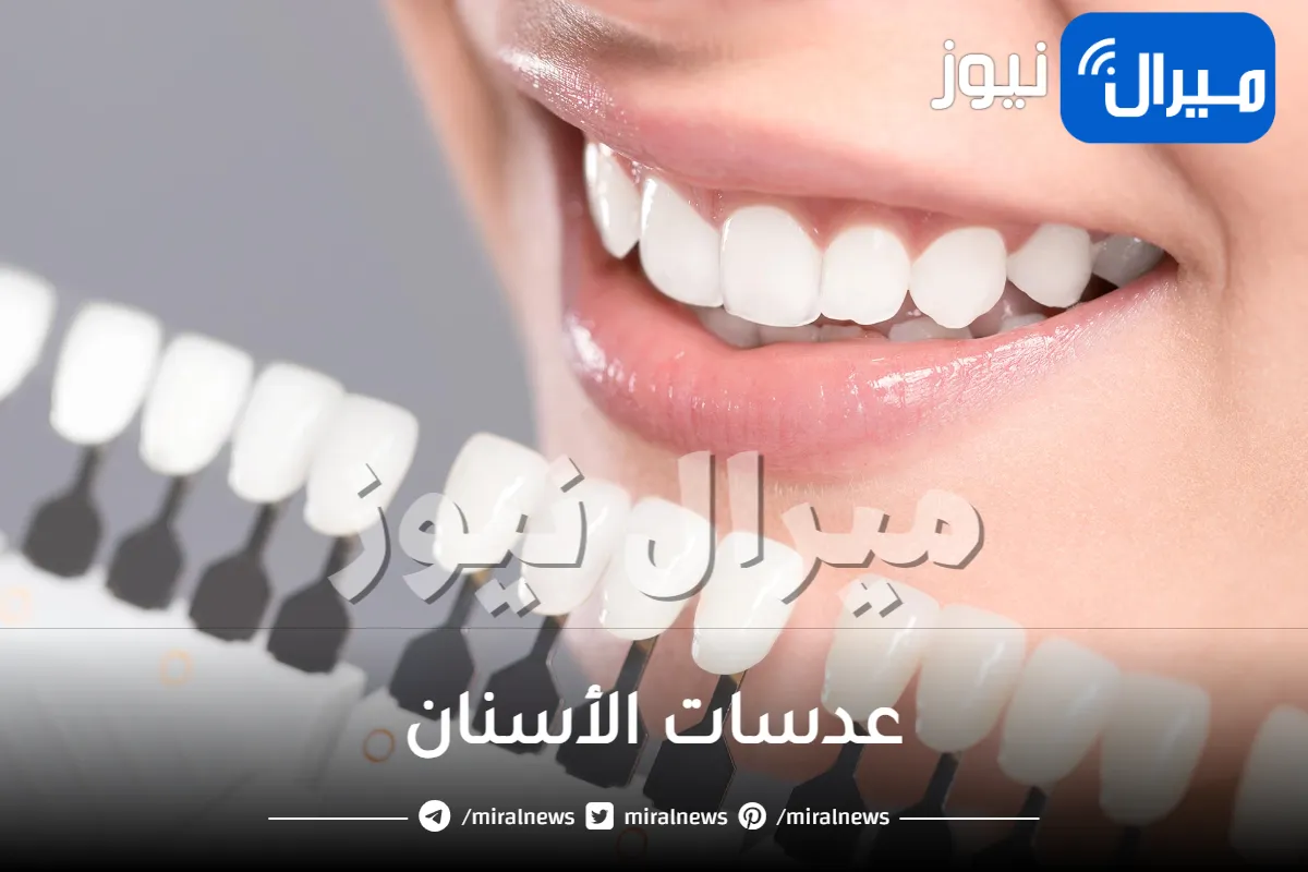 عدسات الأسنان