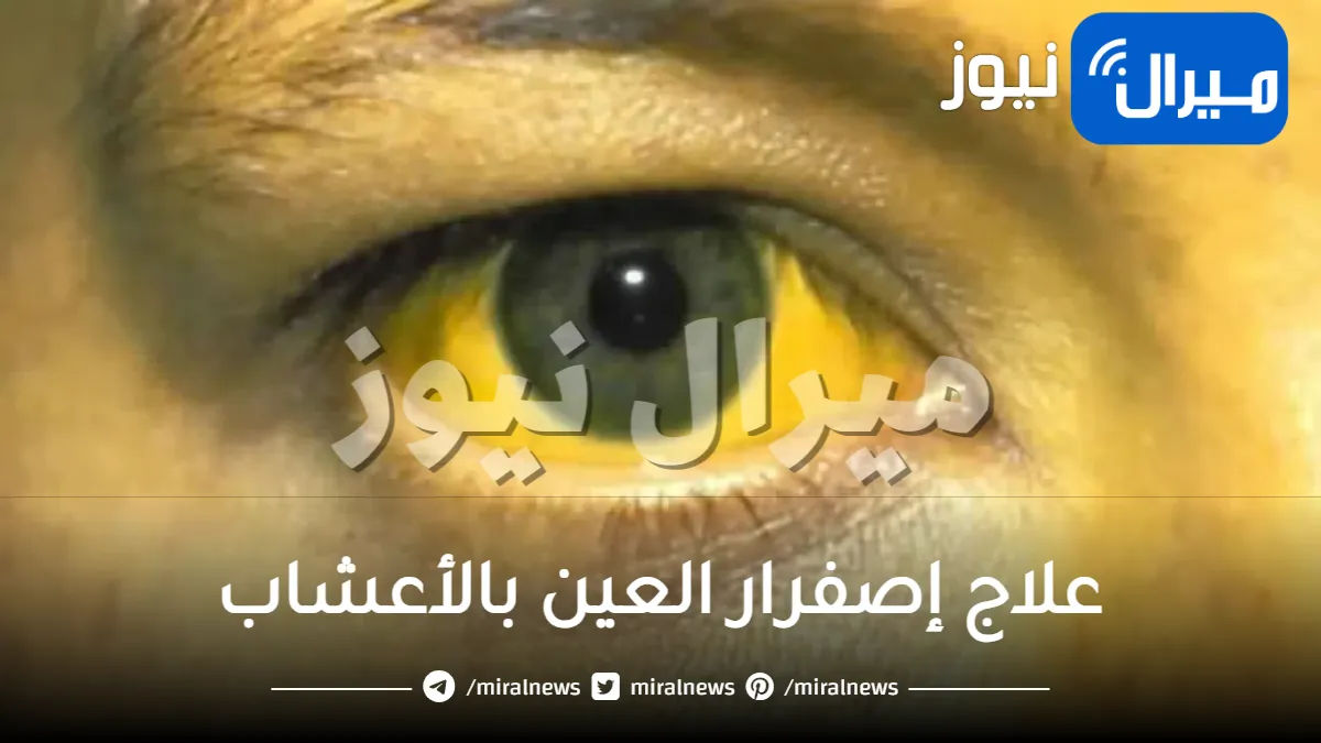 علاج إصفرار العين بالأعشاب .. كيفية علاج صفار العين بالأعشاب الطبيعية