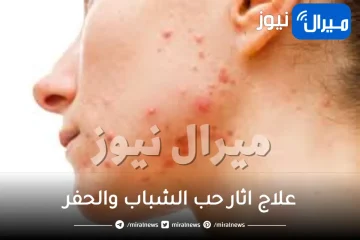 علاج اثار حب الشباب والحفر