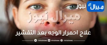 علاج احمرار الوجه بعد التقشير