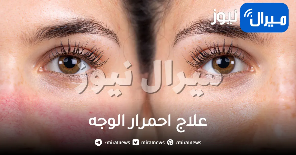 ماهي أفضل الطرق لعلاج احمرار الوجه