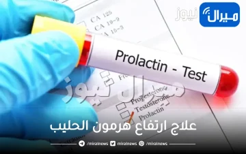 علاج ارتفاع هرمون الحليب