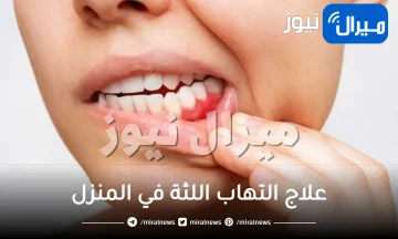 12 علاج التهاب اللثة في المنزل