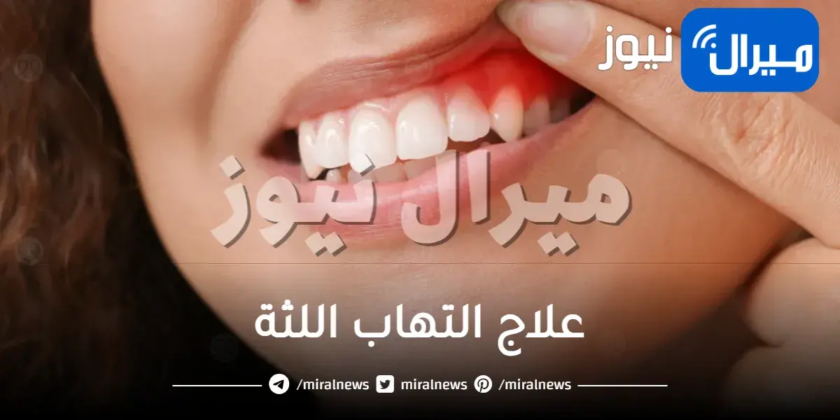 علاج التهاب اللثة