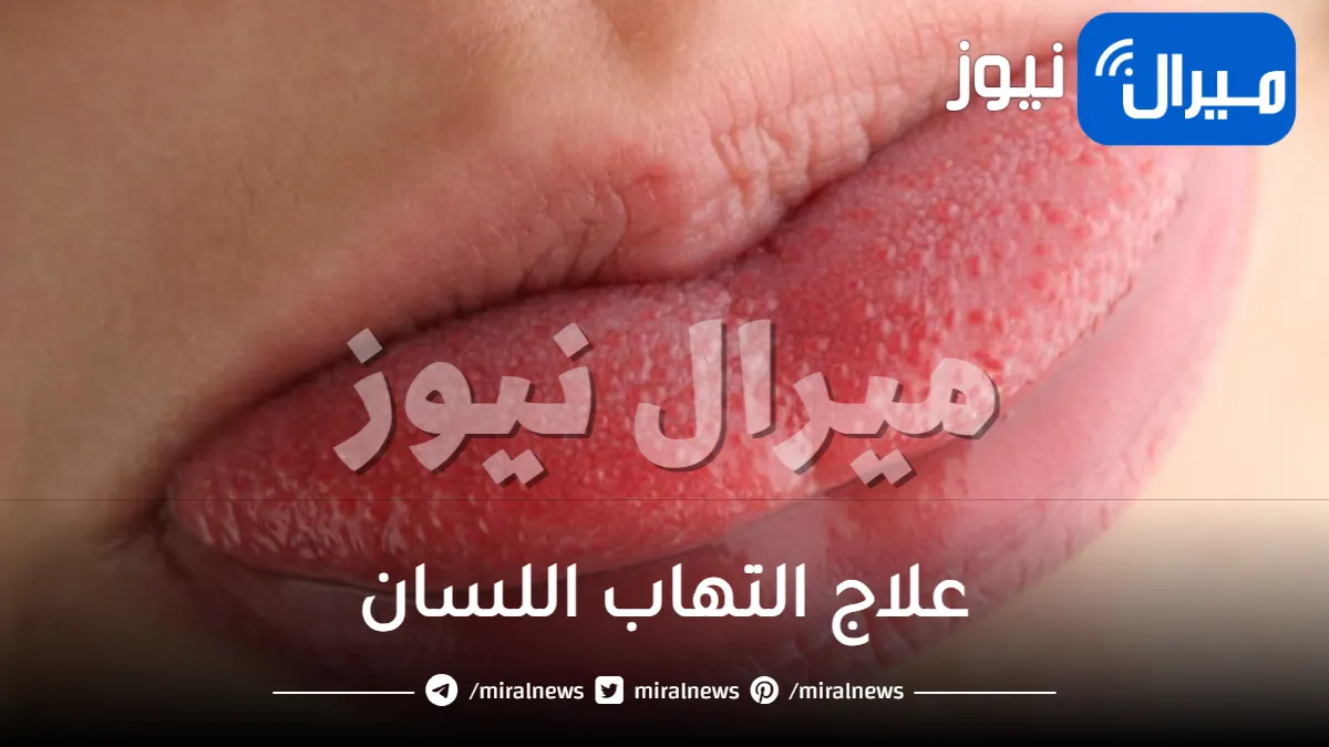 10 طرق فعالة لعلاج التهاب اللسان بسرعة