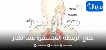 علاج الزغطة المستمرة عند الكبار