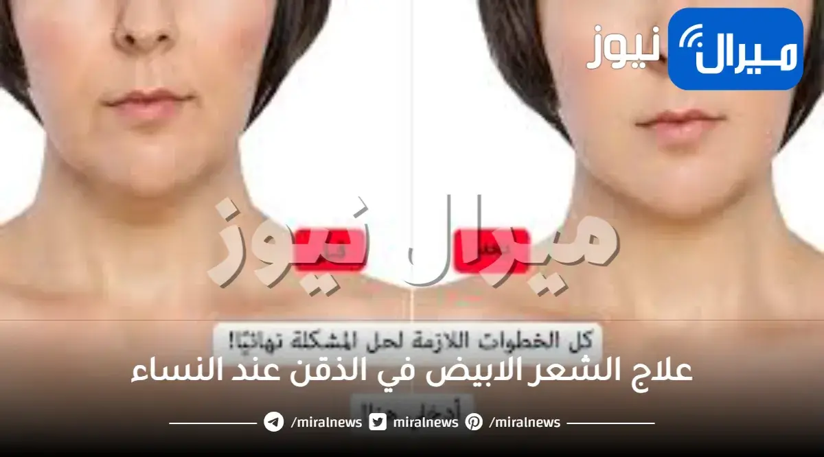 علاج الشعر الابيض في الذقن عند النساء
