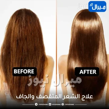 علاج الشعر المتقصف والجاف