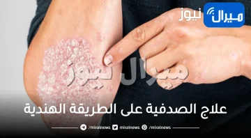 9 طرق لعلاج الصدفية على الطريقة الهندية