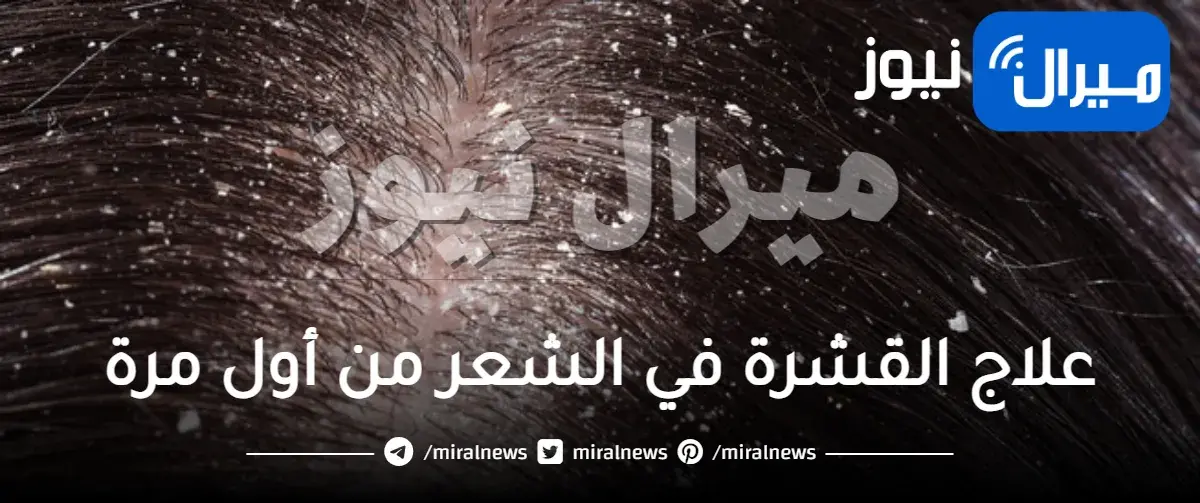 علاج القشرة في الشعر من أول مرة