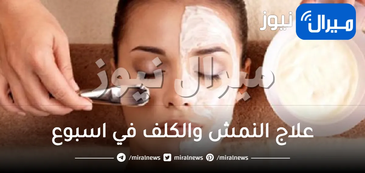 علاج النمش والكلف في اسبوع