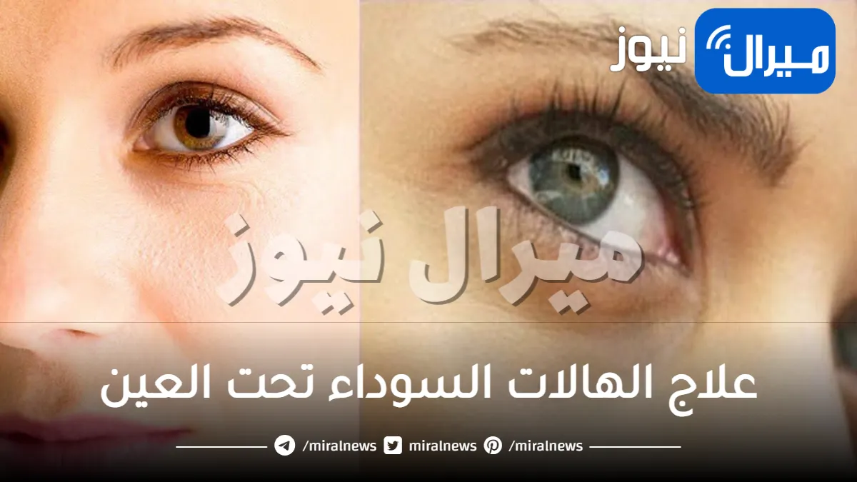 وصفات ونصائح لعلاج الهالات السوداء تحت العين