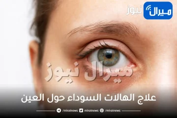 علاج الهالات السوداء حول العين