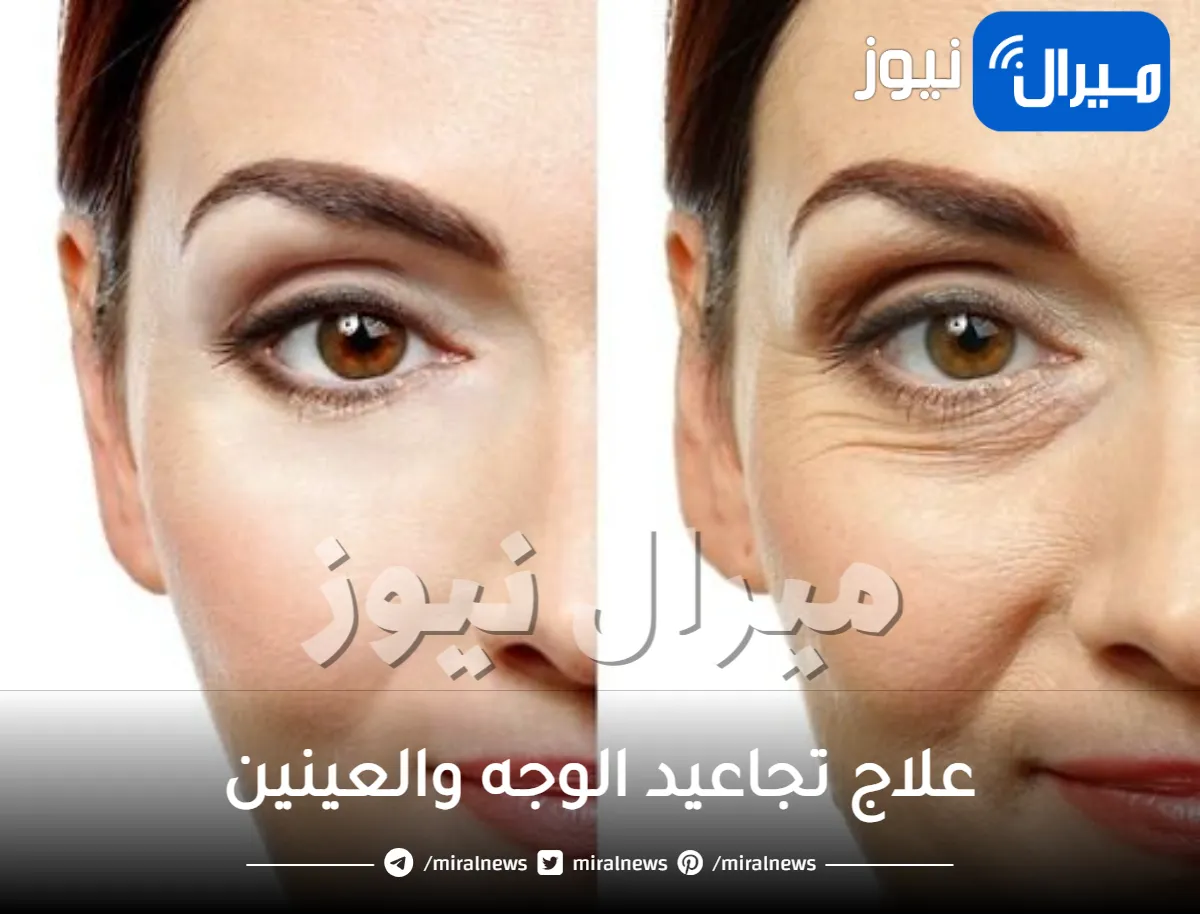 علاج تجاعيد الوجه والعينين .. 5 علاجات فعالة