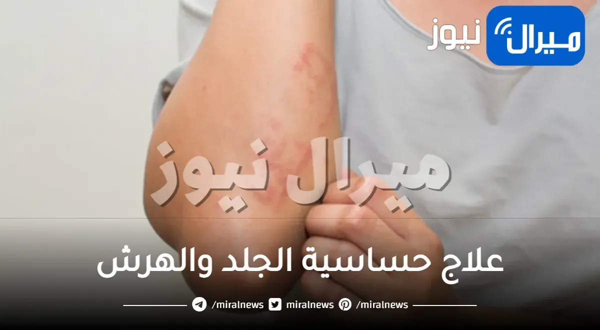 علاج حساسية الجلد والهرش