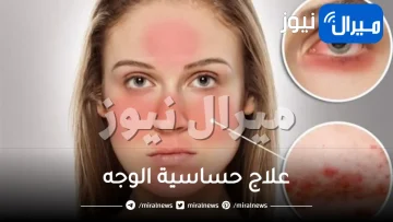 12 طريقة طبيعية لعلاج حساسية الوجه